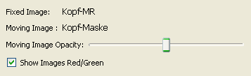 ImageSelectionDeformable.png