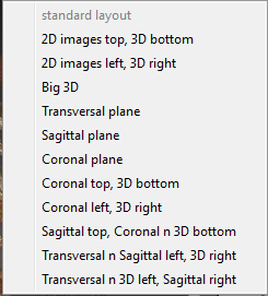 Views_Choices.png
