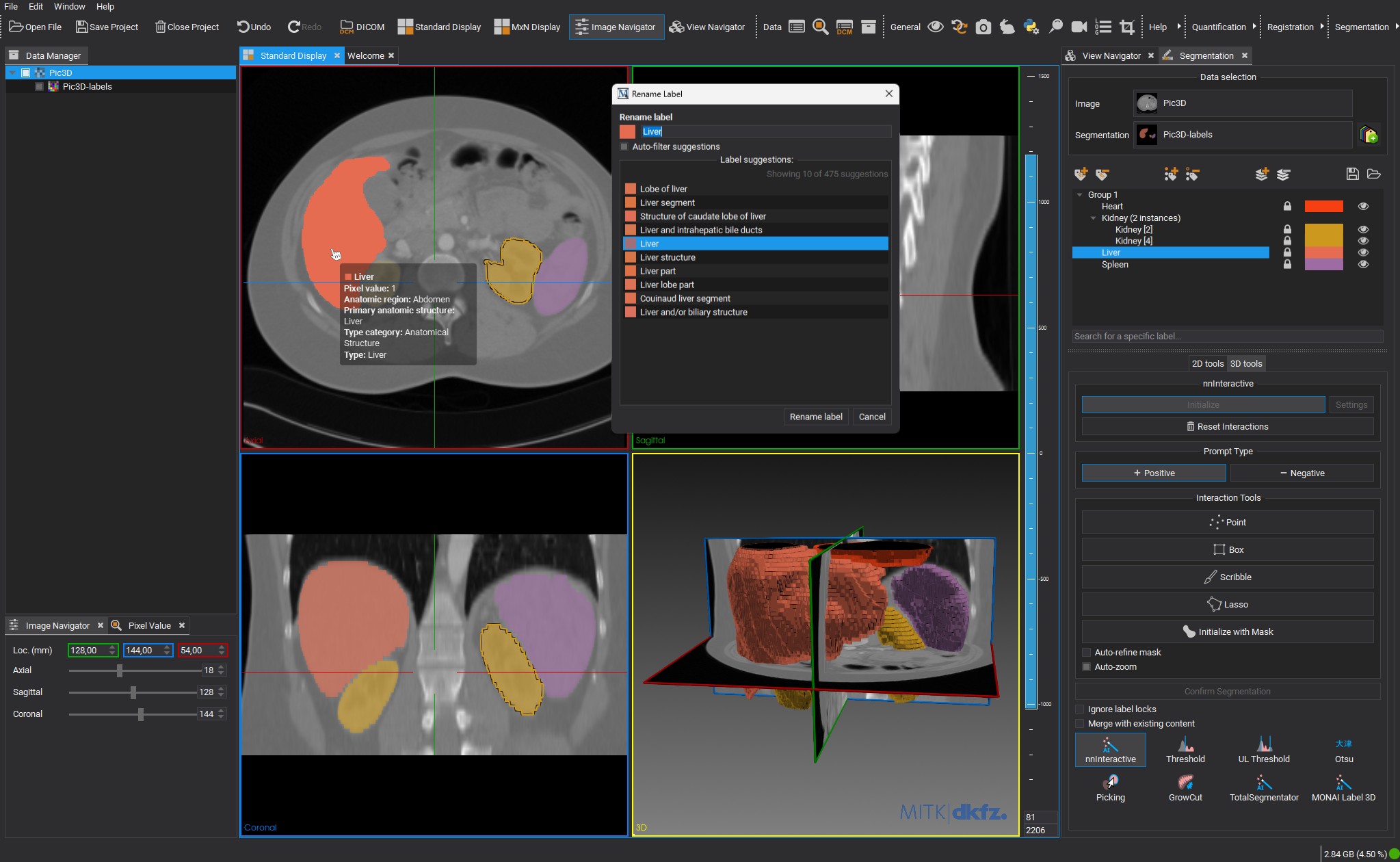 MITK Workbench screenshot