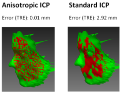 Example registration of a human face performed with the standard alorithm and with the new anisotropic variant