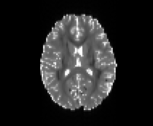 File:Motion axial.gif