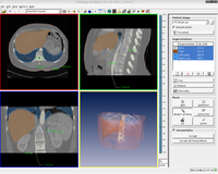 Screenshots$slice based segmentation.png