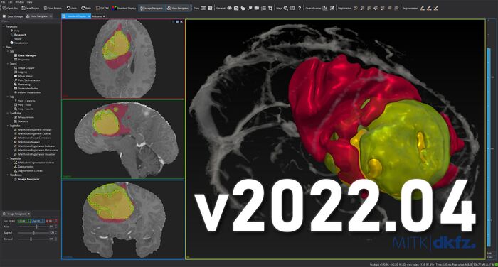 File:MITK-v2022.04-screenshot.jpg