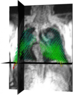 Vector field representing a portion of lung motion