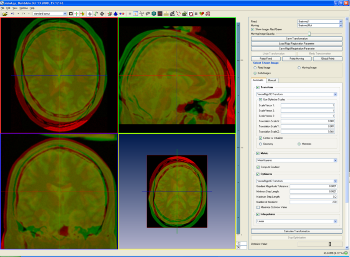 File:Screenshots$RigidRegistrationFunctionality.png