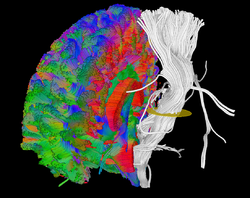 MITK Diffusion