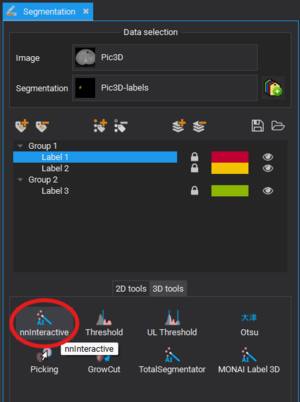 NnInteractive button in Segmentation plugin.png