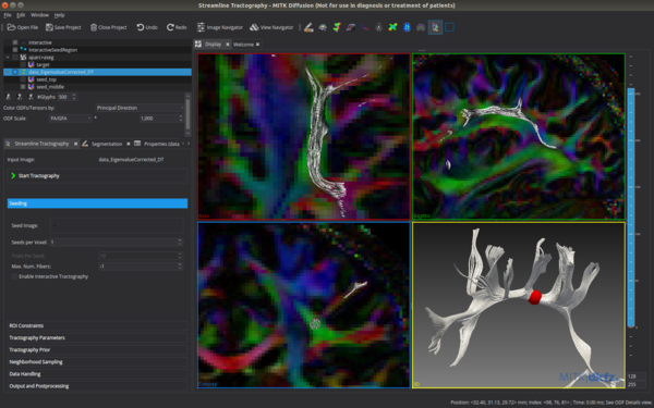 StreamlineTractography.png