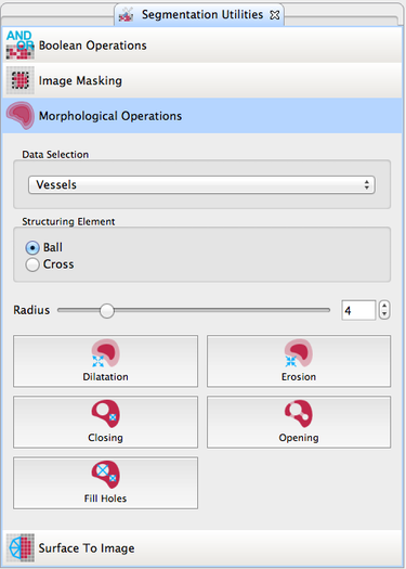 File:MITK$$SegmentationRedesign$SegmentationUtilities.png