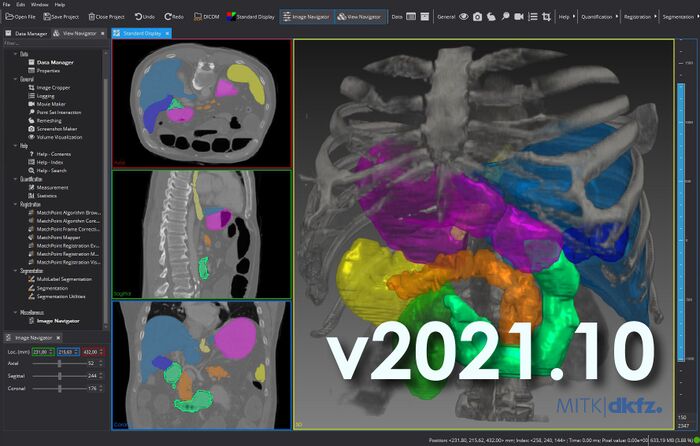 File:MITK-v2021.10-screenshot.jpeg