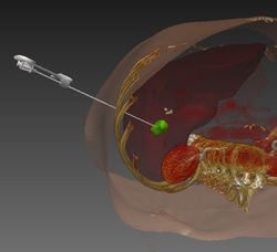 Needle insertion