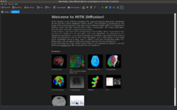 MITK Diffusion