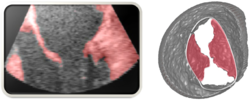 Mitral valve modeling project