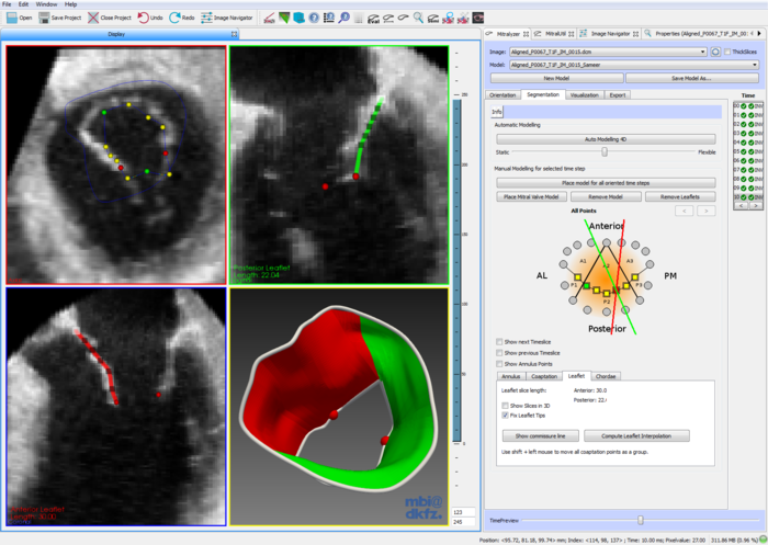 File:Mitralyzer.png