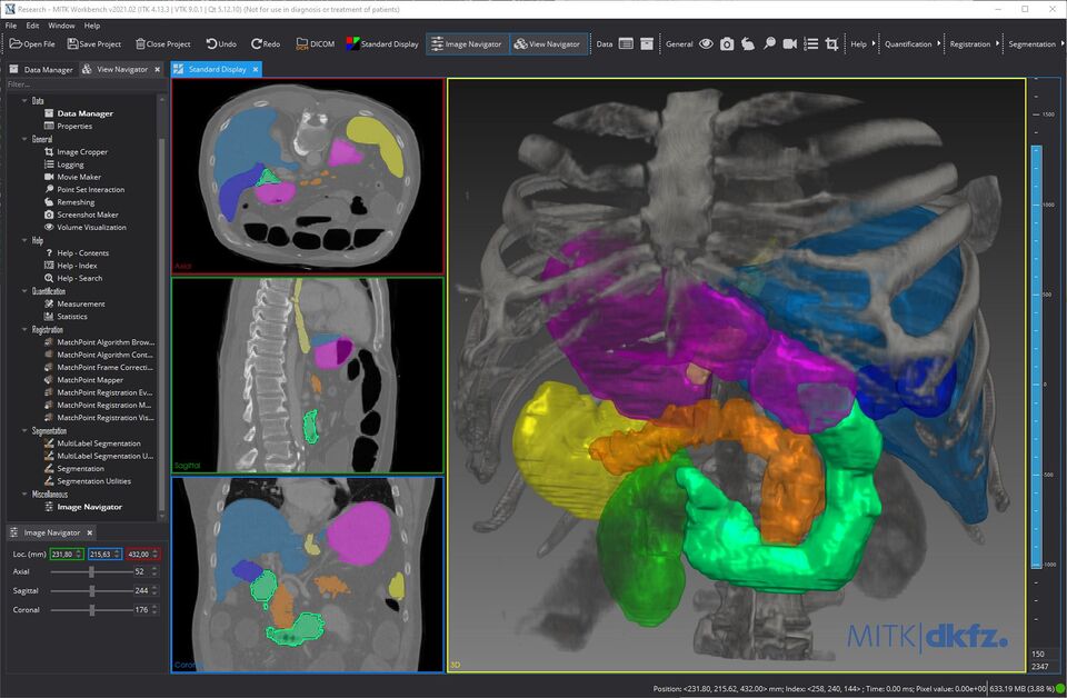 The Medical Imaging Interaction Toolkit (MITK)