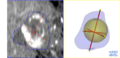 AblationEvaluation$lesion analysis.png