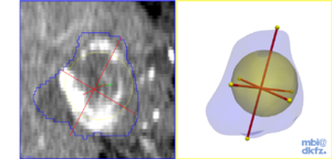 AblationEvaluation$lesion analysis.png