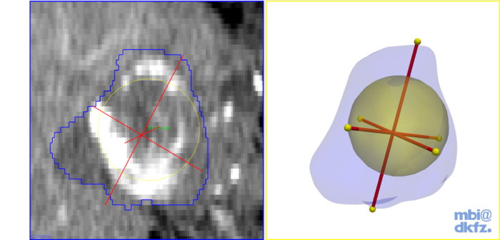 File:AblationEvaluation$lesion analysis.png